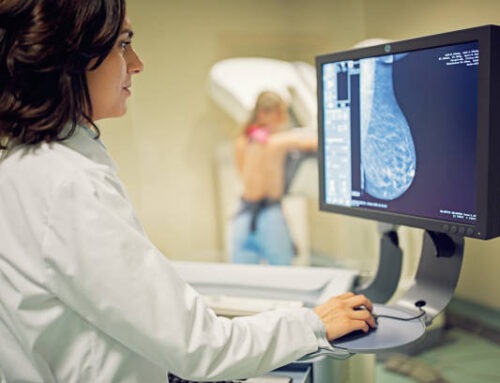 Mammography: Everything you want to know