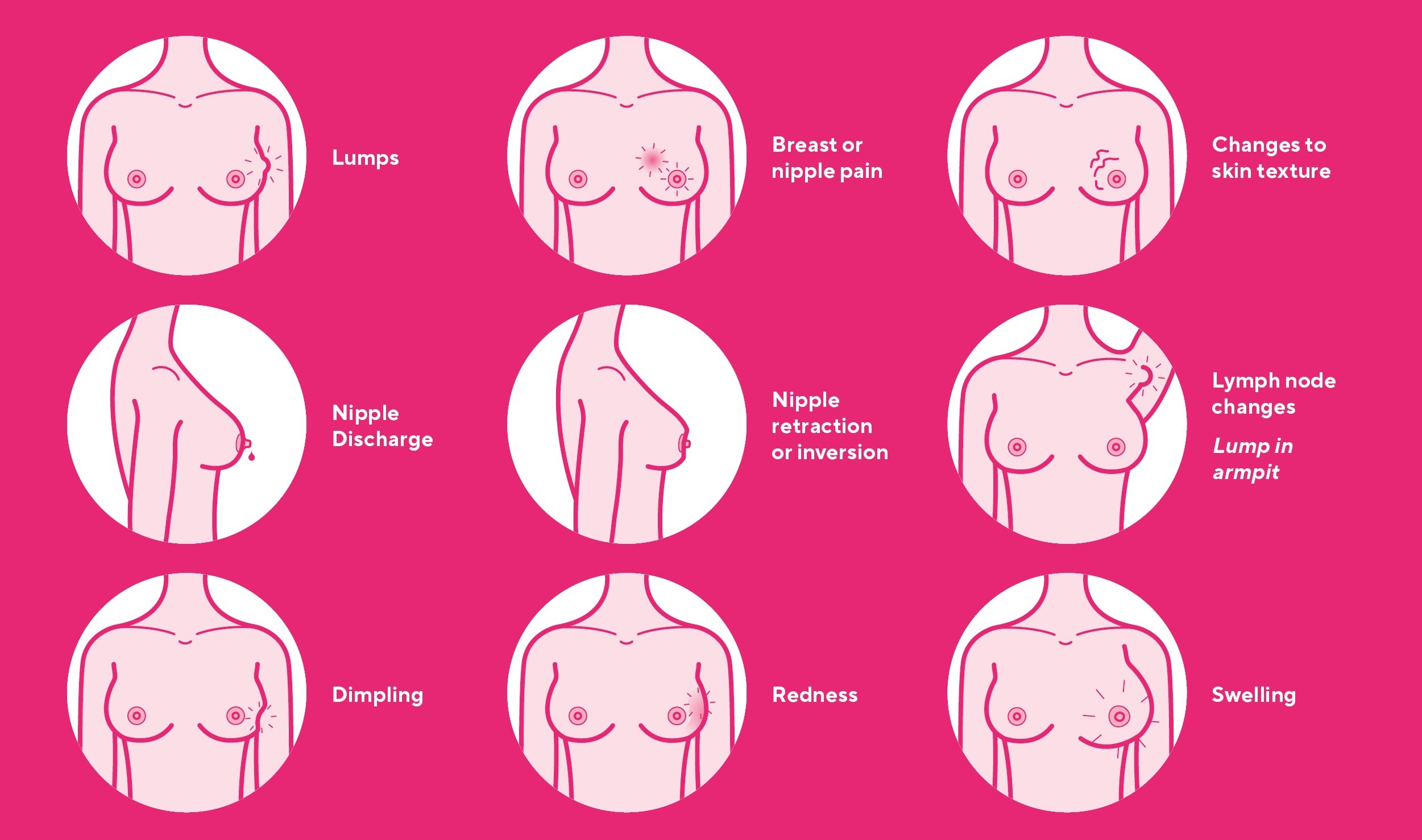 breast cancer Symptoms